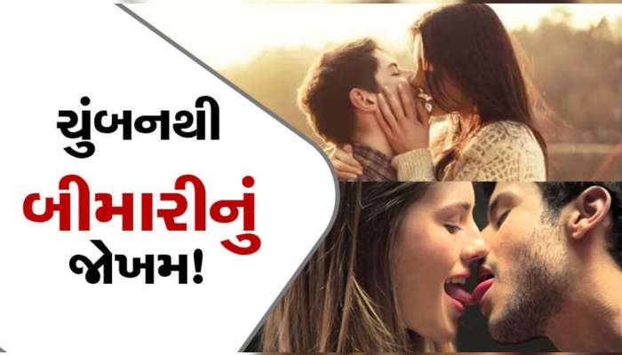 પ્રેમના આવેશમાં ચુંબન કરતા પહેલા આ જાણી લેજો, નહીં તો મજાની જગ્યાએ સજા થઈ જશે!