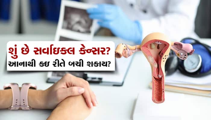 શું છે સર્વાઇકલ કેન્સર? મહિલાઓમાં આ બિમારી કેવી રીતે થાય છે અને બચવા શું કરવું જોઇએ?