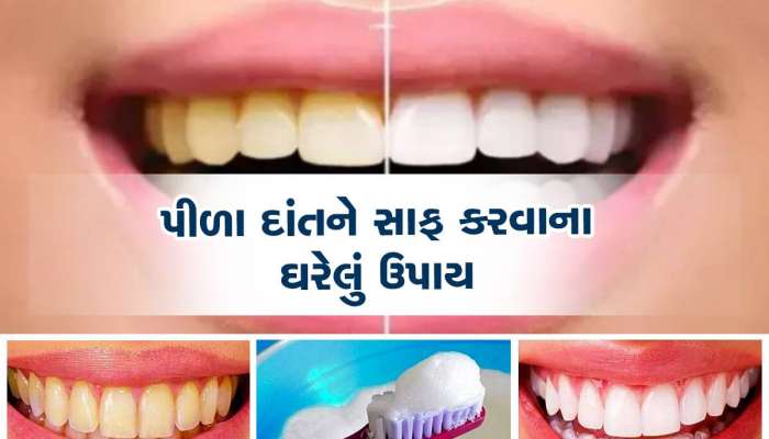 Teeth Whitening: હસવું બની ગયું છે મુશ્કેલ? આ ઘરેલુ ઉપાયોથી મોતી જેવા ચમકશે દાંત
