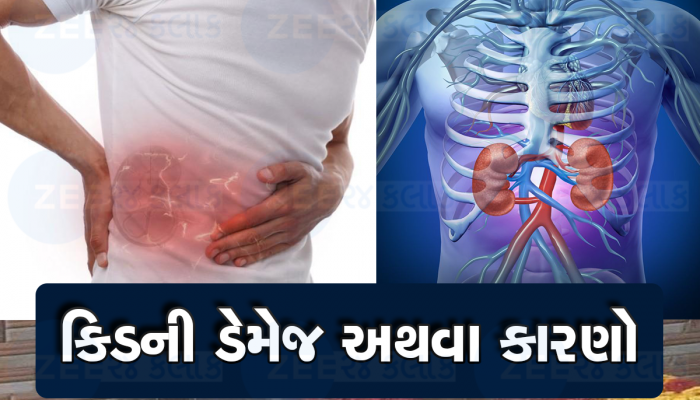 Kidney health: કિડનીને તાજી-માજી રાખવી હોય તો ભૂલથી પણ કરશો નહી આ ભૂલ, શોધવા નિકળવું પડશે ડોનર