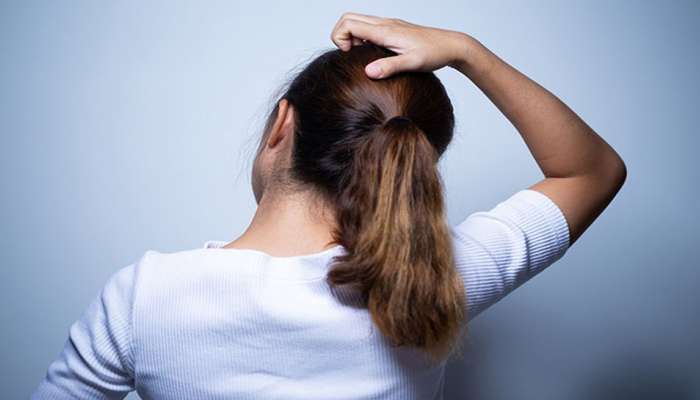 Itchy Scalp: ગરમીમાં વધી જતી માથાની ખંજવાળની સમસ્યાને દૂર કરવા અપનાવો આ ઘરેલુ ઉપાય