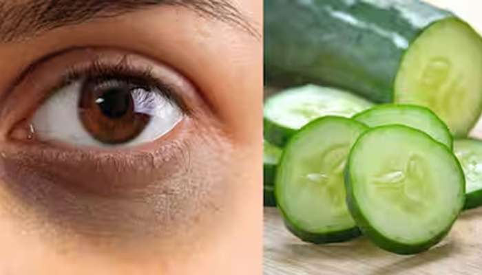 Dark Circles: કાકડી ગણતરીના દિવસોમાં દુર કરશે ડાર્ક સર્કલ્સ, 3 રીતે ઉપયોગ કરી શકો છો
