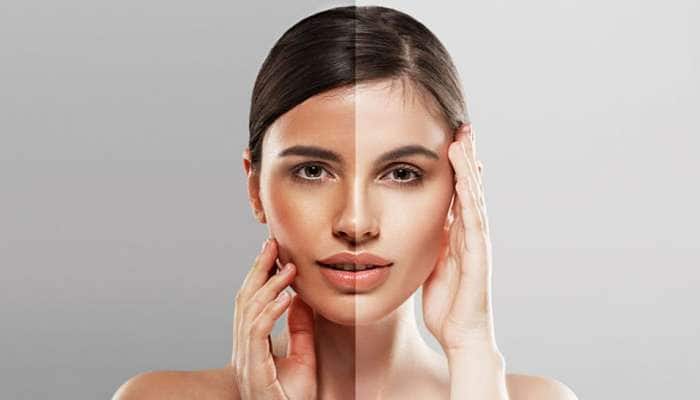 Skin Care: ટેનિંગ દૂર કરવા આ 3 રીતે દહીંનો કરો ઉપયોગ, 10 મિનિટમાં ચહેરો ચમકી જશે