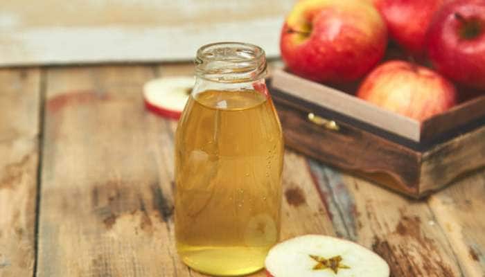 Apple cider vinegar: બધાને જોઈ તમે વિનેગર પીવાનું શરુ કરો તે પહેલા જાણો તેની આડઅસરો 