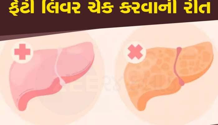 લિવર ફેટી છે કે નહીં, તમારા કોલરની સાઇઝથી પડી જશે ખબર, આ રીતે કરો ચેક