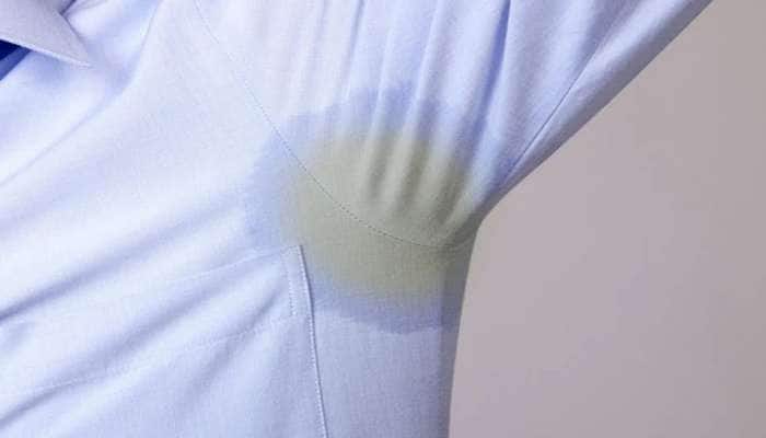 Sweat Stains: કપડામાંથી આવતી પરસેવાની વાસ અને ડાઘ દુર કરવા ટ્રાય કરો ઘરગથ્થુ નુસખા