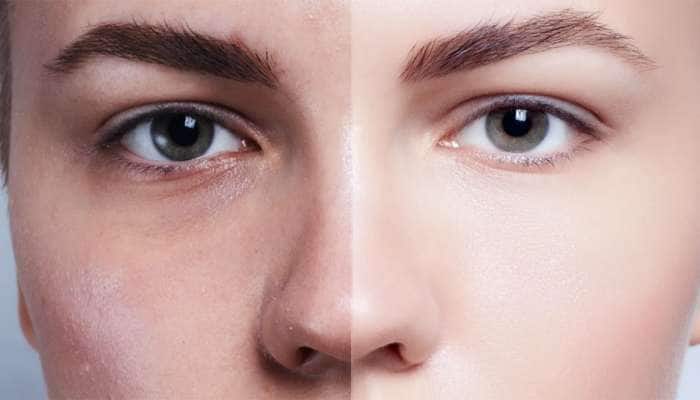 ચહેરા પર મોંઘી ક્રીમને બદલે આ 5 સસ્તી વસ્તુનો ઉપયોગ કરો, રાતોરાત ત્વચા પર દેખાશે ચમક
