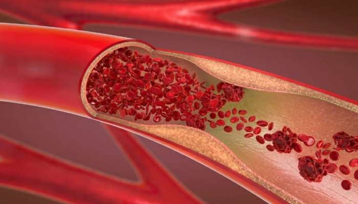 Healthy Heart: સવારે વાસી મોઢે આ 5 માંથી કોઈ 1 વસ્તુ પીવાનું રાખો, ધમનીઓ નહીં થાય બ્લોક અને હાર્ટ રહેશે હેલ્ધી