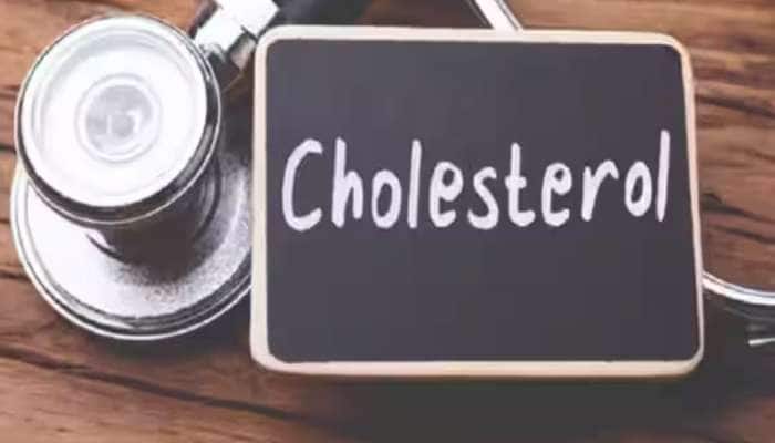 Cholesterol ઘટાડવા માટે કરો આ 5 વસ્તુનું સેવન, બીમારીઓ રહેશે દૂર