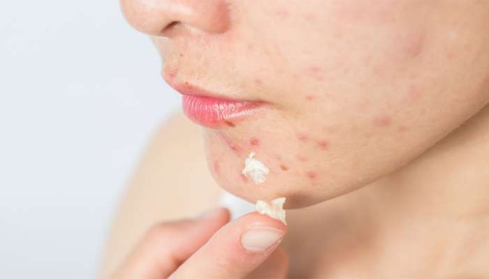 Beauty Hacks: ઊલમાંથી ચૂલમાં પડશો... જો સમજ્યા વિના અજમાવશો આવા બ્યુટી હૈક્સ, આ ટ્રેંડને ભુલ પણ ફોલો ન કરતાં