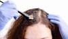 Onion For White Hair: માથામાં વધતી સફેદીને કંટ્રોલ કરવી હોય તો આ રીતે ડુંગળીનો કરો ઉપયોગ