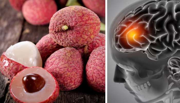 lychee: એક દિવસમાં કેટલી લીચી ખાવી સુરક્ષિત ? આ વાતનું ધ્યાન ન રાખવામાં આવે તો લીચી મગજની નસોને કરે ડેમેજ 