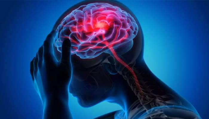 Brain Stroke Signs: મગજ સુધી ન પહોંચતું હોય લોહી ત્યારે જોવા મળે છે આ 5 લક્ષણો