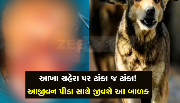 ઘોડિયામાં સૂતા બાળકને રખડતા કૂતરાએ ફાડી ખાધો, જીવ તો બચ્યો પણ 100 ટાંકા, એક આંખ કાઢવી પડી