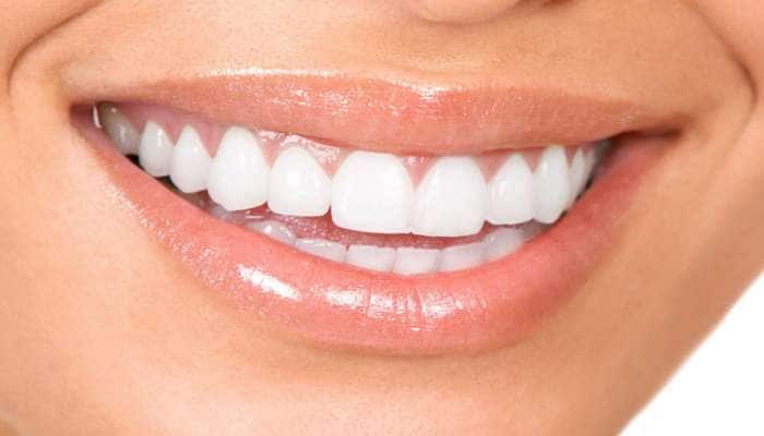White Teeth: ઘરમાં રહેલી આ 5 વસ્તુઓથી દાંત થઈ જાશે મોતી જેવા સફેદ, એકવાર કરો ટ્રાય