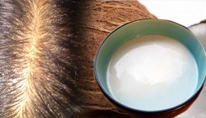Hair Fall: હાથમાં આવે છે વાળના ગુચ્છા ? તો વાળ ધોતા પહેલા લગાડો આ સફેદ વસ્તુ, ખરતા વાળની સમસ્યા થશે દુર