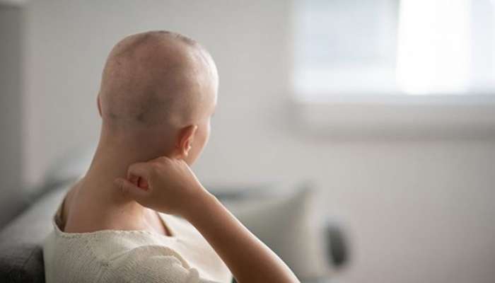 Chemotherapy Side Effects: કેન્સરની સારવાર દરમિયાન શા માટે ખરી જાય વાળ ? કેટલા સમય પછી ઉગે નવા વાળ?