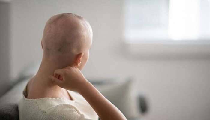 Chemotherapy: કેન્સરની સારવારમાં શા માટે ખરી જાય વાળ? કેટલા સમય પછી ઉગે નવા વાળ ?
