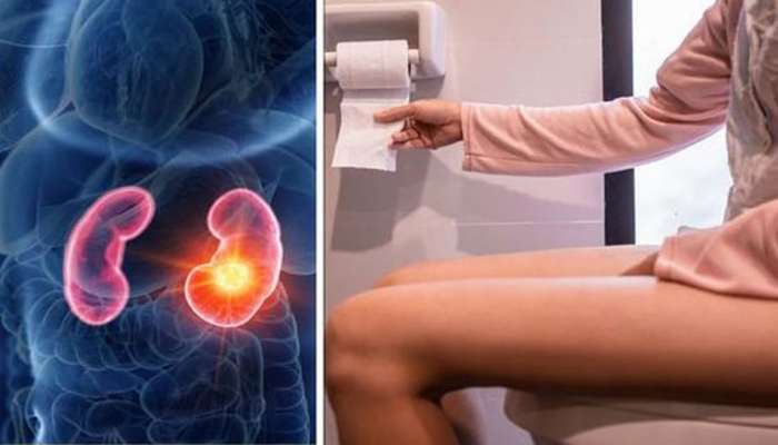 Kidney Damage Symptoms: પેશાબમાં દેખાવા લાગે છે આ લક્ષણ તો સમજી લેજો કિડની થઈ રહી છે ડેમેજ