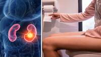 Kidney Damage Symptoms: પેશાબમાં દેખાય આ લક્ષણ તો સમજી લેજો કિડની થવા લાગી છે ડેમેજ