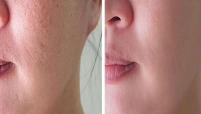 Skin Care Routine: રાત્રે સૂતા પહેલા ચહેરા પર લગાવો આ તેલ, સ્કિન ટાઈટ થવા સહિત થશે આ 5 ફાયદા
