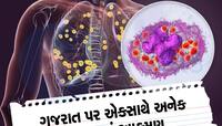 સુરતની મહિલા દુર્લભ વાયરસના ઝપેટમાં, મહાબળેશ્વરની ગુફામાંથી ચામાચીડિયાનો ચેપ લઈ આવી