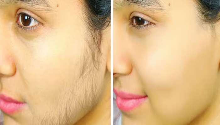 વેક્સિંગ કે થ્રેડિંગ કરાવ્યા વિના દુર કરવી હોય ચહેરાની રુંવાટી તો ટ્રાય કરો આ નુસખા 