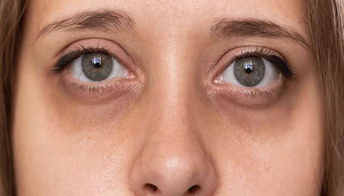 Skin Care Tips: શરીરમાં આ 2 વિટામિન ઓછા હોય તો સ્કિન થવા લાગે કાળી, ચહેરો થઈ જાય ખરાબ