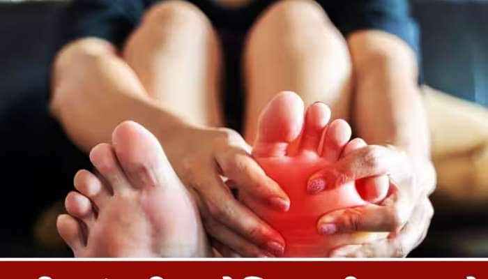 Uric Acid: આ 5 વસ્તુઓથી દૂર થાય છે યુરિક એસિડ, પેશાબ વાટે એસિડ નીકળશે બહાર