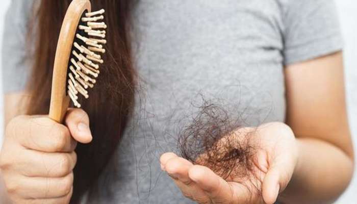 Hair Fall: આ 3 વિટામિનને ડાયટમાં સામેલ કરશો તો વાળ ખરતા બંધ થઈ જશે, ટ્રાય કરી જુઓ એકવાર
