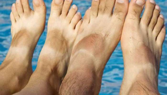 Foot Tanning: બિલકુલ નથી પસંદ પગની કાળાશ! આ 2 વસ્તુઓથી કરો દૂર