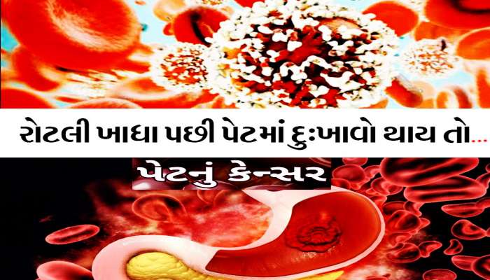 ધીરે ધીરે રોજ તમારા પેટમાં જમા થાય છે ઝેર! થઈ શકે છે પેટનું કેન્સર, શરૂઆતમાં દેખાય છે આવા લક્ષણો