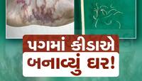 અરેરાટી થઈ જાય તેવો કિસ્સો! 7 વર્ષના બાળકના પગમાં ઘૂસી ગયા કીડા