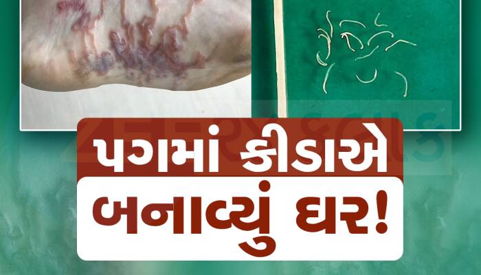 અરેરાટી થઈ જાય તેવો કિસ્સો! 7 વર્ષના બાળકના પગમાં ઘૂસી ગયા કીડા
