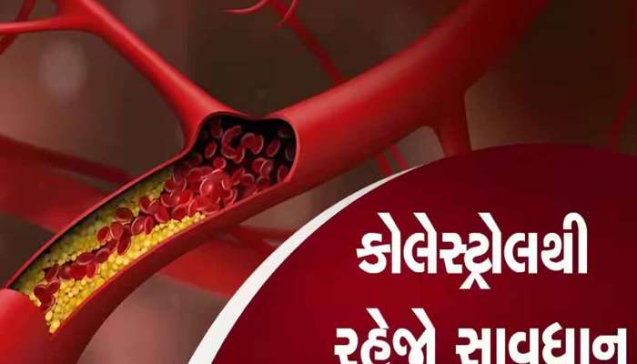 આ ખોરાક શરીરમાં વધારે છે ખરાબ કોલેસ્ટ્રોલ, શિયાળામાં ચાખવાની પણ હિંમત ના કરતા