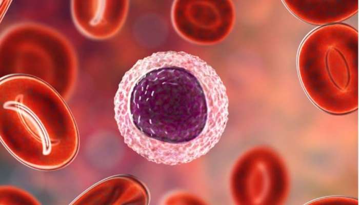 Blood Cancer: શું ખાવા-પીવાની ખોટી આદતો આપે છે બ્લડ કેન્સરને આમંત્રણ? એક્સપર્ટ પાસેથી જાણો હકીકત