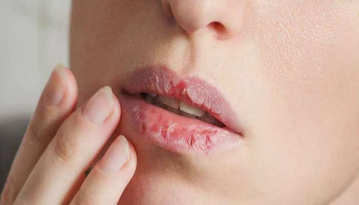 Dry Lips: આ 5 ટીપ્સ ફોલો કરશો તો શિયાળામાં હોઠ ફાટશે નહીં, ગુલાબની પાંદડી જેવા કોમળ રહેશે