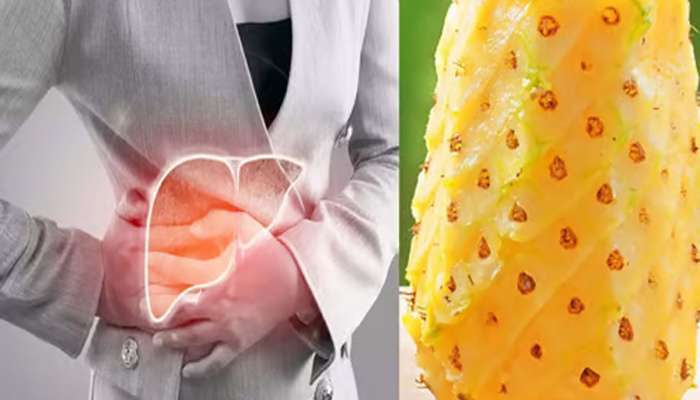 Pineapple: આ 4 બીમારીમાં અનાનસ ખાવું મોંઘું પડશે, ખાવાથી હોસ્પિટલના ધક્કા વધી જશે
