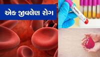 આ શહેરમાં જીવલેણ રોગનો હાહાકાર! હવે તો લક્ષણોમાં પણ ફેરફાર, ઓળખવો બન્યો મુશ્કેલ