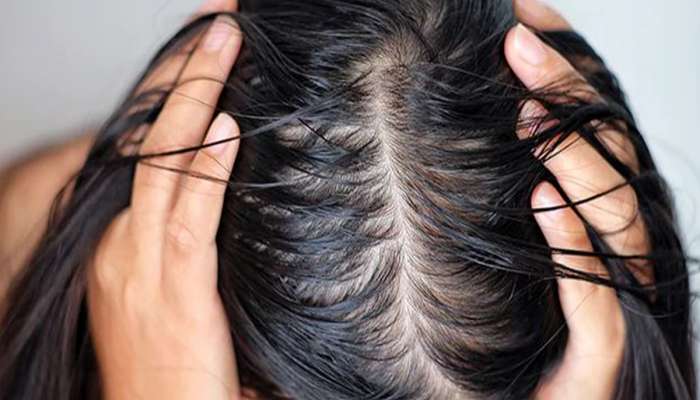 Greasy Hair: શું તમે પણ ચીકણા વાળથી પરેશાન છો? તો આ આદતો બદલો