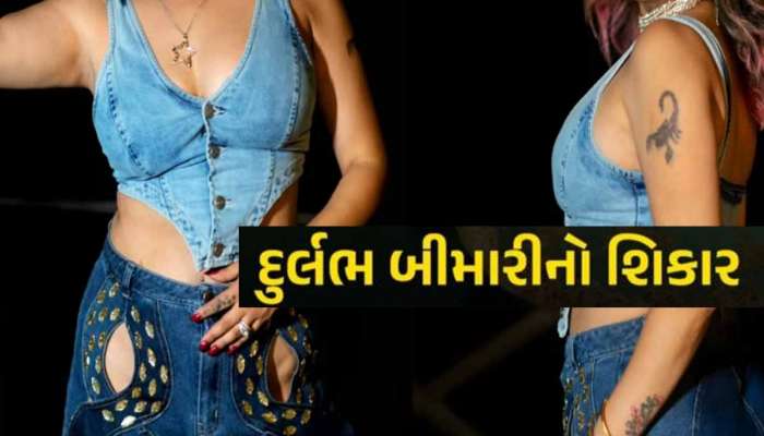 બોલીવુડની ફેમસ સિંગરને ગંભીર બિમારી, 10 કિલો વજન ઘટ્યું! કહ્યું; 'આ બિમારી મારી...'