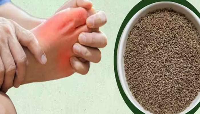 સાંધામાં જામેલા યુરિક એસિડને તોડીને બહાર કાઢી નાખશે આ વસ્તુ, દુખાવો તુરંત મટશે