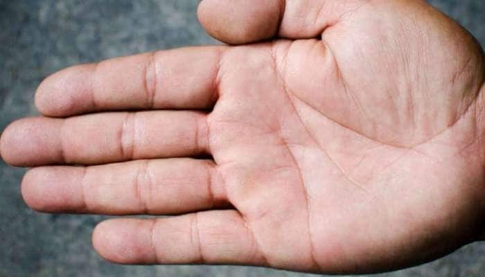 ધનવાન લોકોની હથેળી પર હોય છે આ તલ, જાણો હાથમાં ક્યાં-ક્યાં તલ હોવું કઈ વાતનો સંકેત