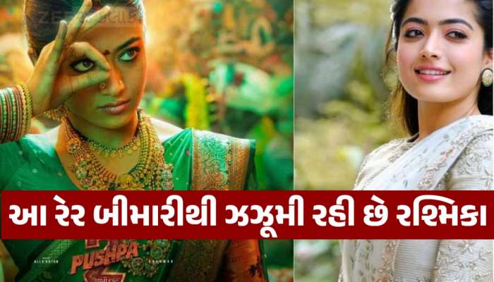  શું આ રેર બીમારીથી ઝઝૂમી રહી છે રશ્મિકા મંદાના! જાણો તેના લક્ષણ અને કારણ
