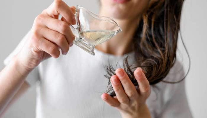 Hair Fall: આ શાકની છાલથી અટકી જશે ખરતા વાળ, કચરામાં ફેંકવાનું બંધ કરી આ રીતે યુઝ કરો