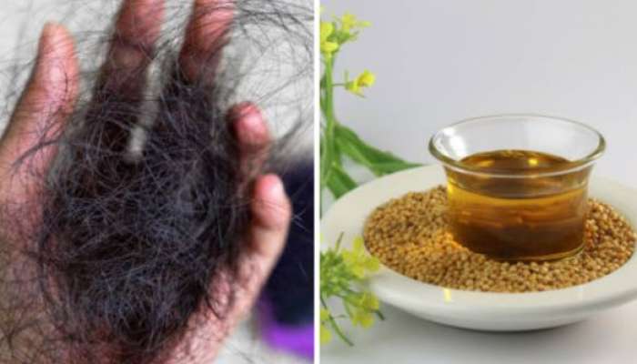 ટૂટી રહ્યા છે વાળના ગુચ્છે ગુચ્છા? સરસ્યાના તેલમાં મિક્સ કરીને લગાવો આ 3 વસ્તુ, અઠવાડિયામાં કંટ્રોલ થઈ જશે હેર ફોલ