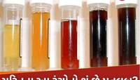 Urine Colour: પીળો, લીલો, ભૂરો અને લાલ, યૂરિનના આ 6 રંગ બતાવશે તમારી સ્વાસ્થ્યનો હાલ