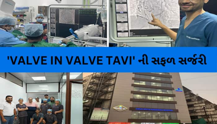 INS PLUS હોસ્પિટલના સુપરસ્પેશિયાલિસ્ટ, નિષ્ણાંત અને પ્રતિષ્ઠિત ડોકટરોની ટીમ દ્વારા..