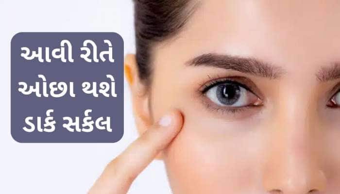 આંખોની નીચે રહેલા કાળા કુંડાળા થશે છૂમંતર, ફોલો કરો બસ આ 7 સરળ ટિપ્સ
