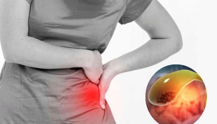 Health Tips: પિત્તાશયમાં પથરીની શરુઆત હોય તો દિવસમાં 2 વાર પીવો આ રસ, ટુકડા થઈ નીકળી શકે છે બહાર